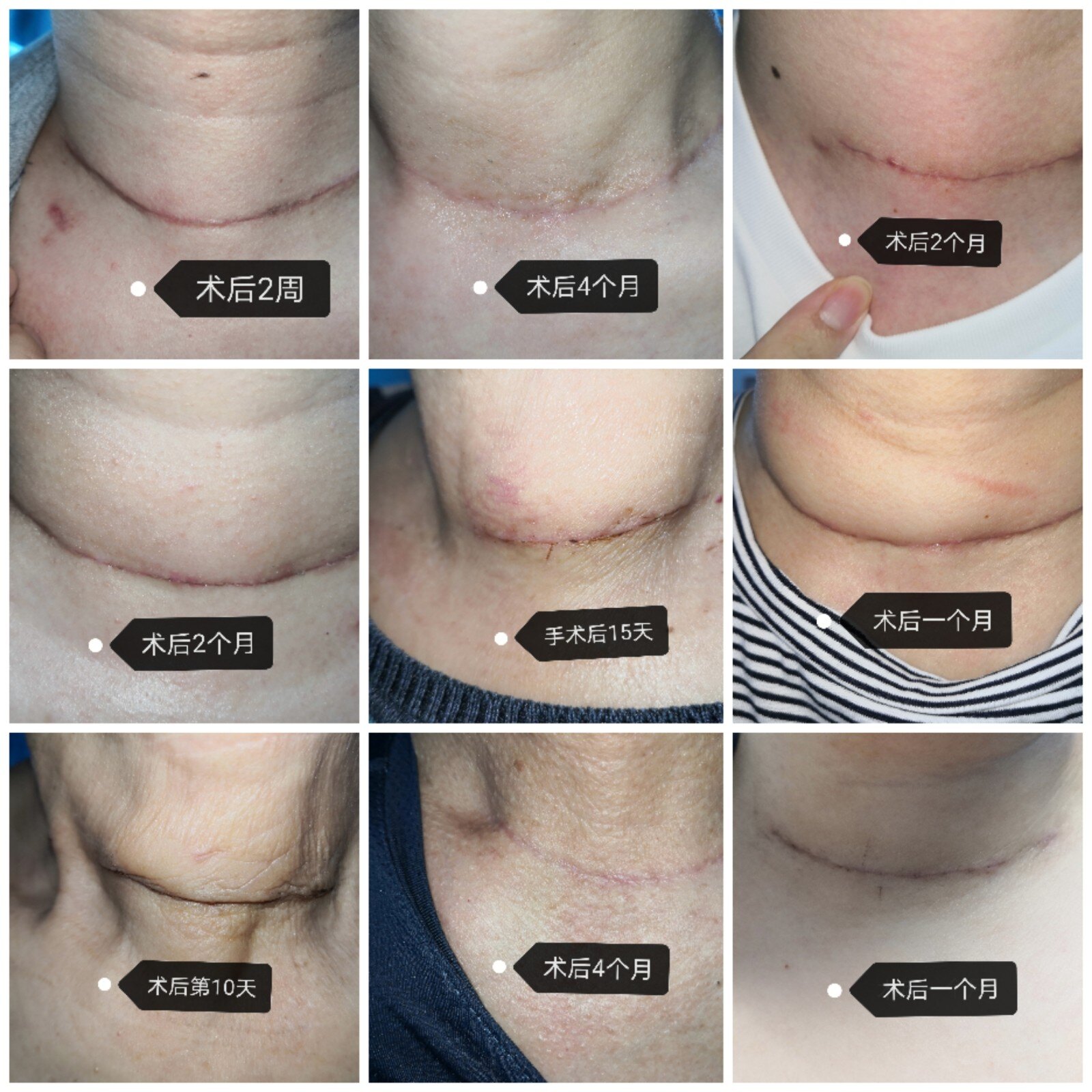 1628062688809755.jpg 1628062688809755.jpg