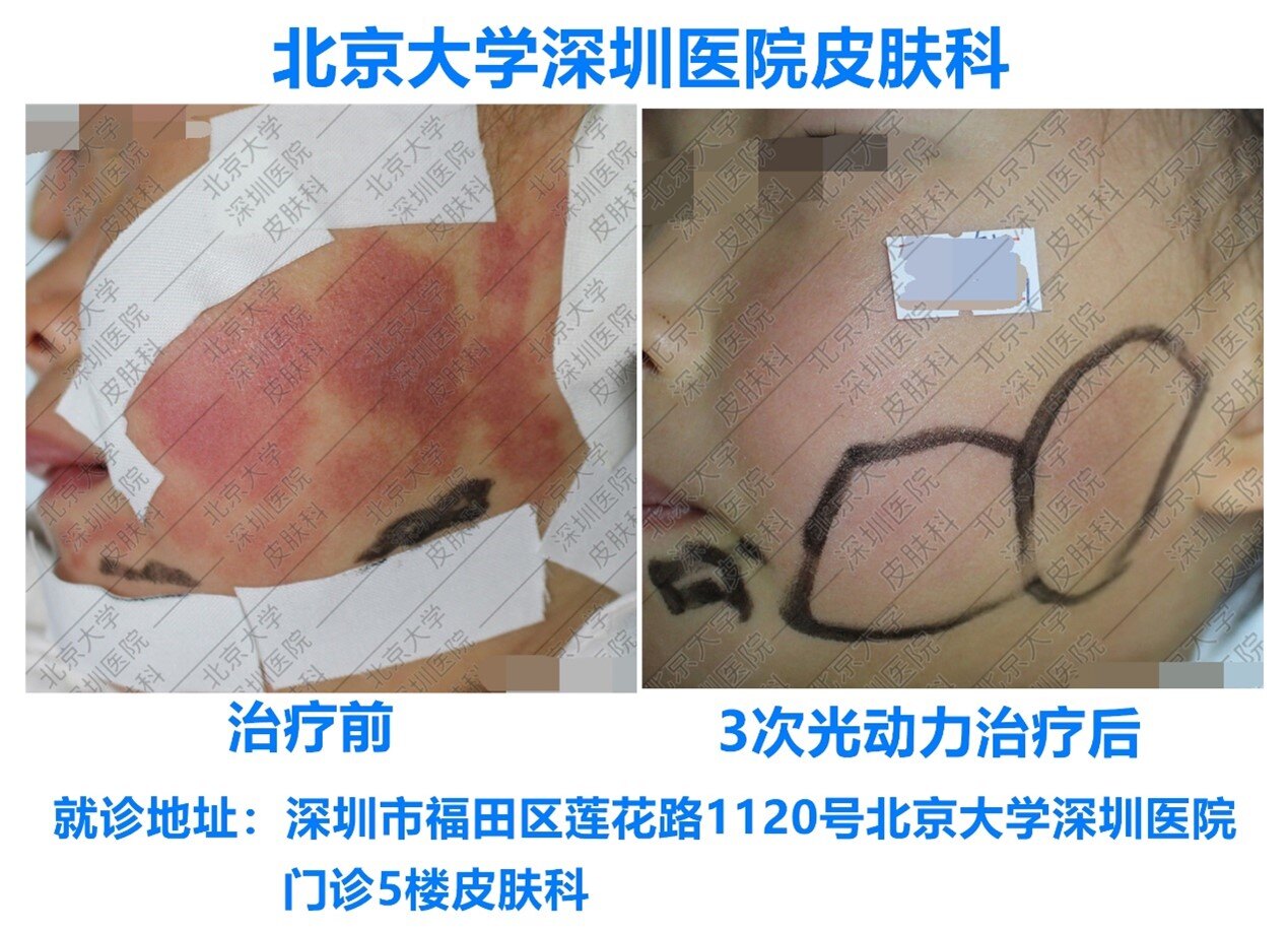 病例五.jpg