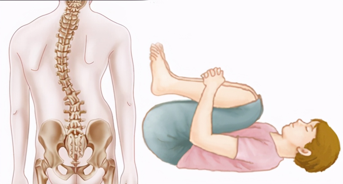 18岁少女脊柱侧弯,竟是一个姿势惹的祸