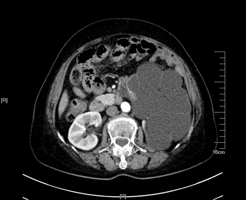 1497276226883040.jpg 23.JPG