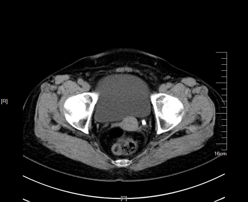 1497277189442610.jpg 51.JPG