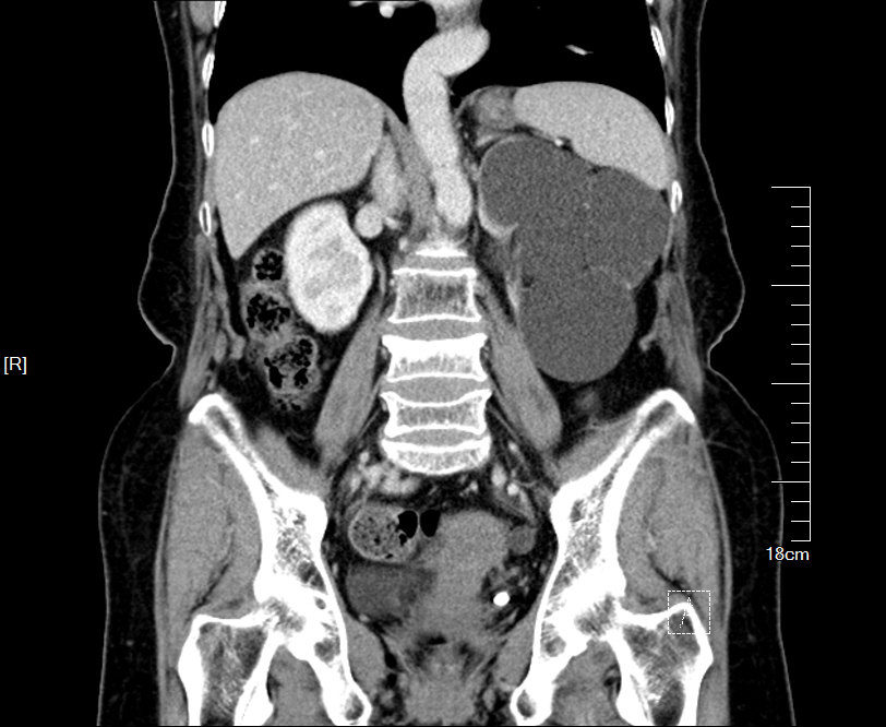 1497276265866133.jpg 34.JPG