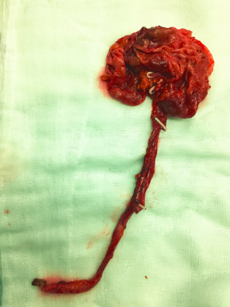 1497278137220547.png 无标题3456.png