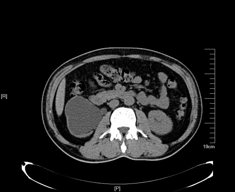 1497442342255784.jpg 45.JPG