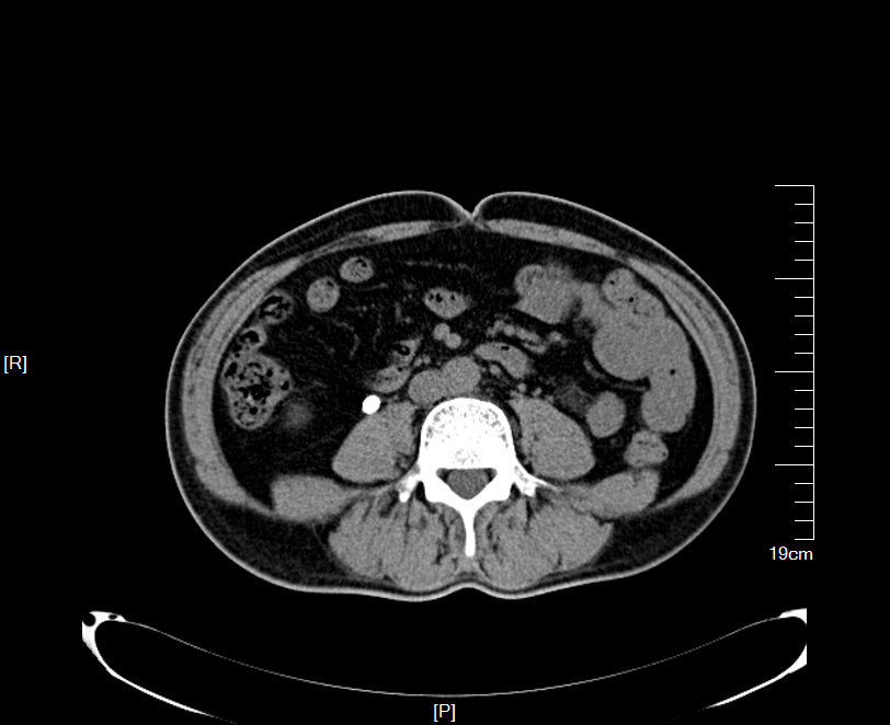 1497442407121332.jpg 55.JPG