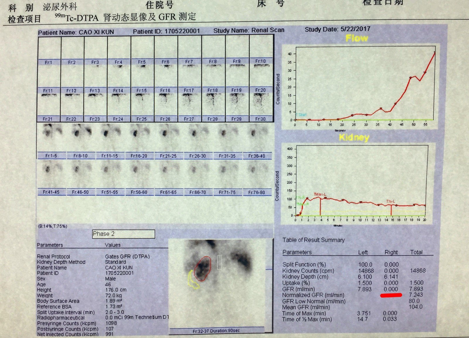 1497442602295508.jpg IMG_0617.JPG