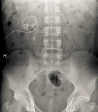 1497442832681124.png 无标题457.png