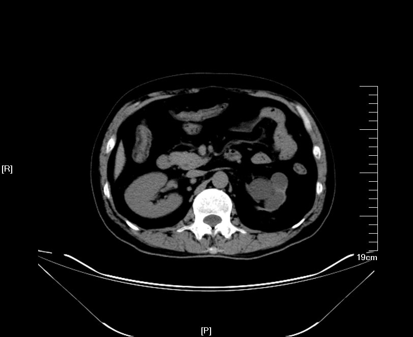 1512274154863182.jpg 27.JPG