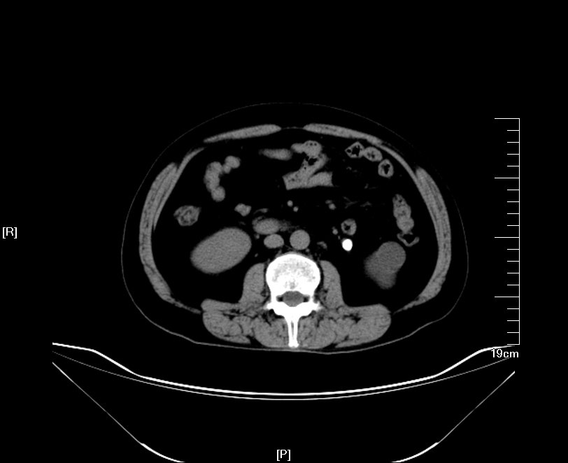 1512274219447978.jpg 37.JPG