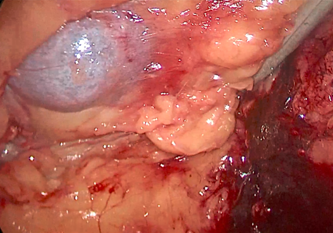 1512274752314715.png 无标题34t456.png