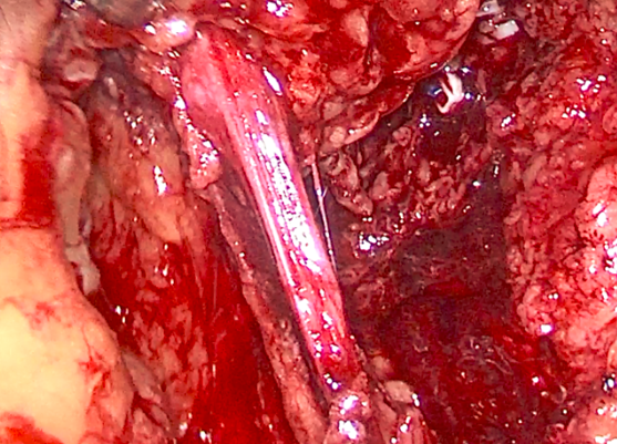 1512274812650460.png 无标题3656567.png