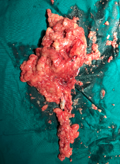 1512274840411771.png 无标题564256.png