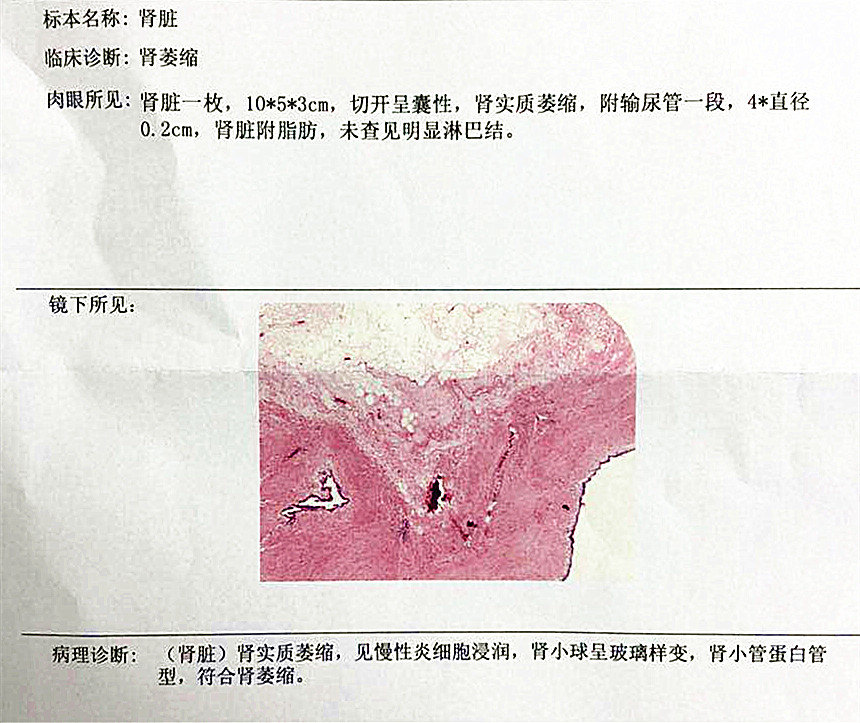 1512443343215188.jpg webwxgetmsgimg.jpg