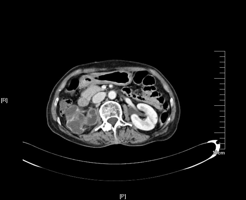 1490752619383413.jpg 21.JPG