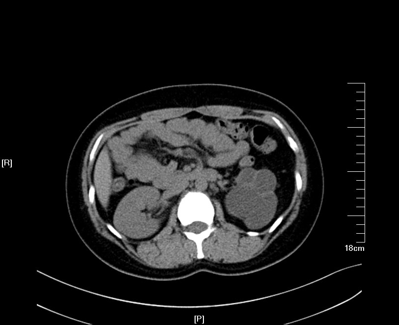 1522507564534047.jpg 26.JPG