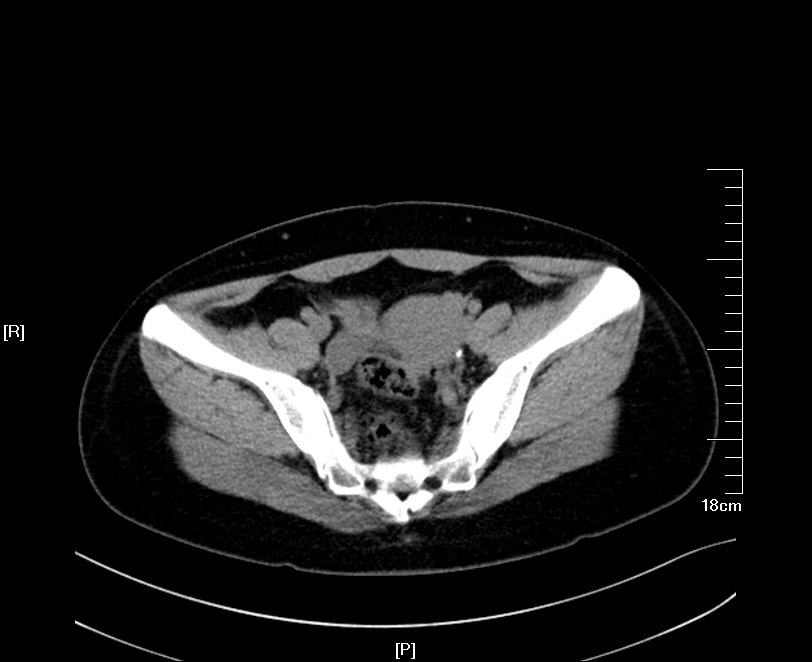 1522507715992403.jpg 57.JPG