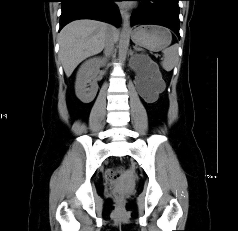 1522507764886215.jpg 23.JPG