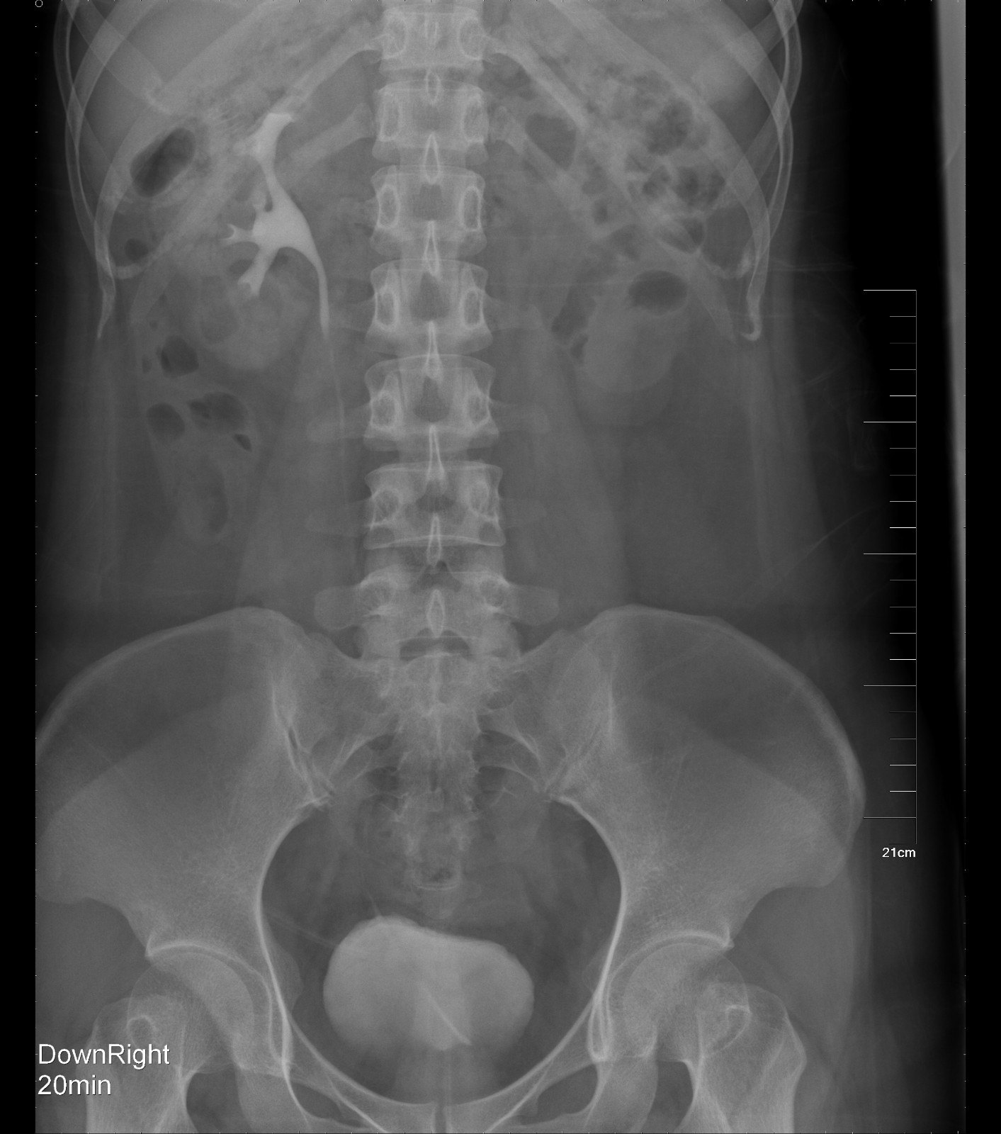 1522507799749557.jpg 1.JPG