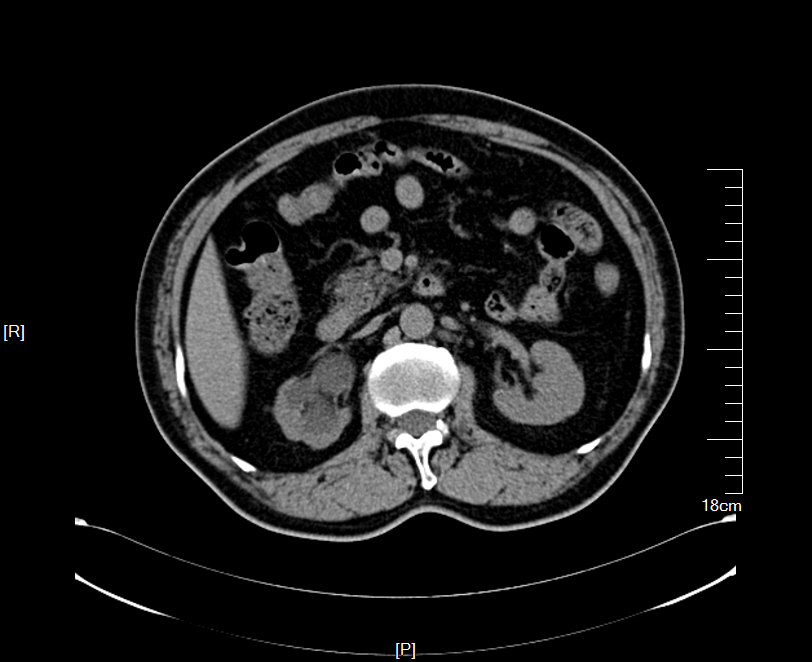 1587028712288329.jpg 33.JPG