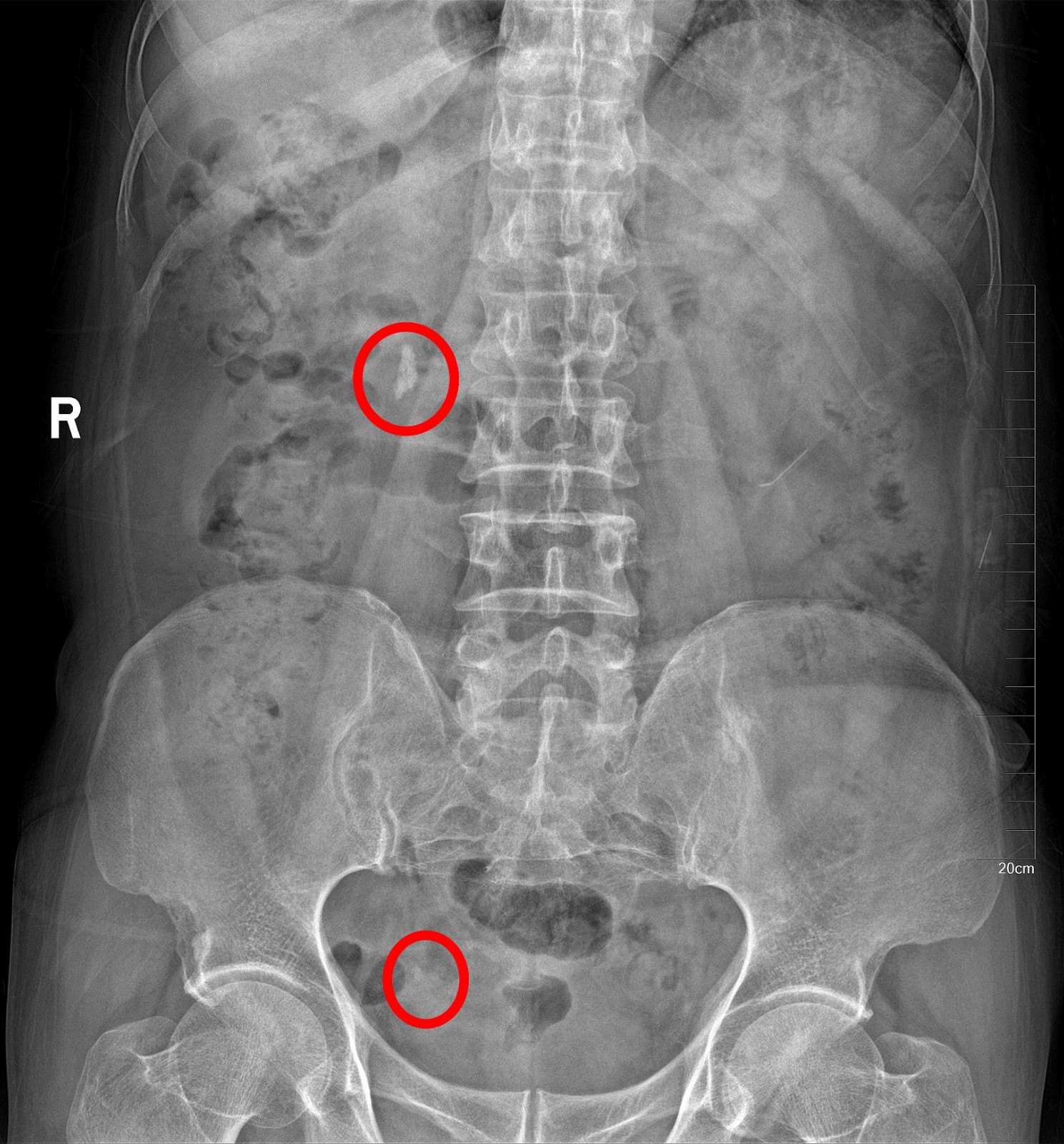 1587028777995431.jpg 12.JPG