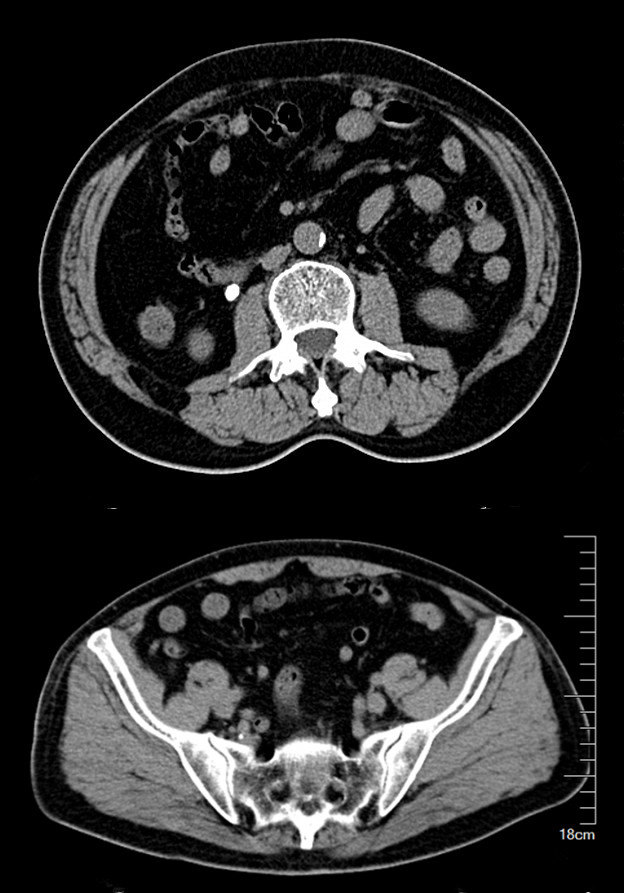 1587028858670153.jpg 71.JPG