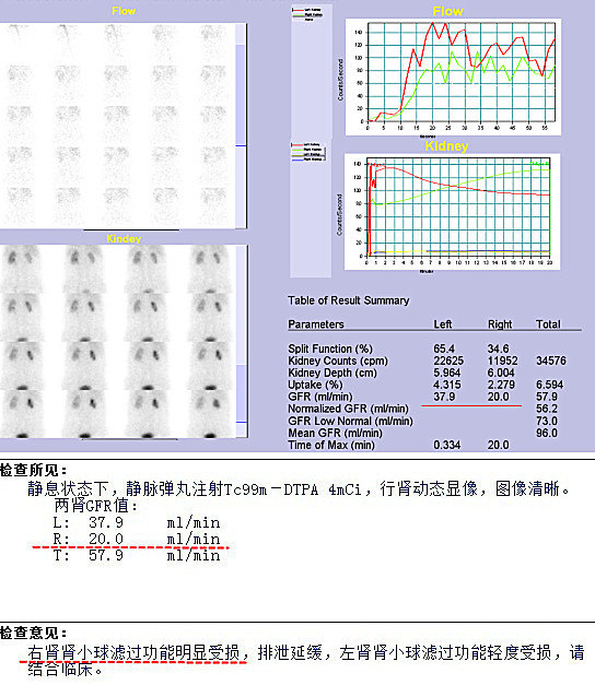 1587125095374191.jpg 1.JPG