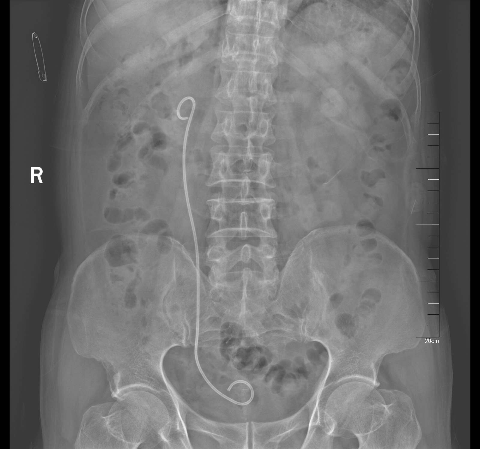 1587269000884785.jpg 1.JPG