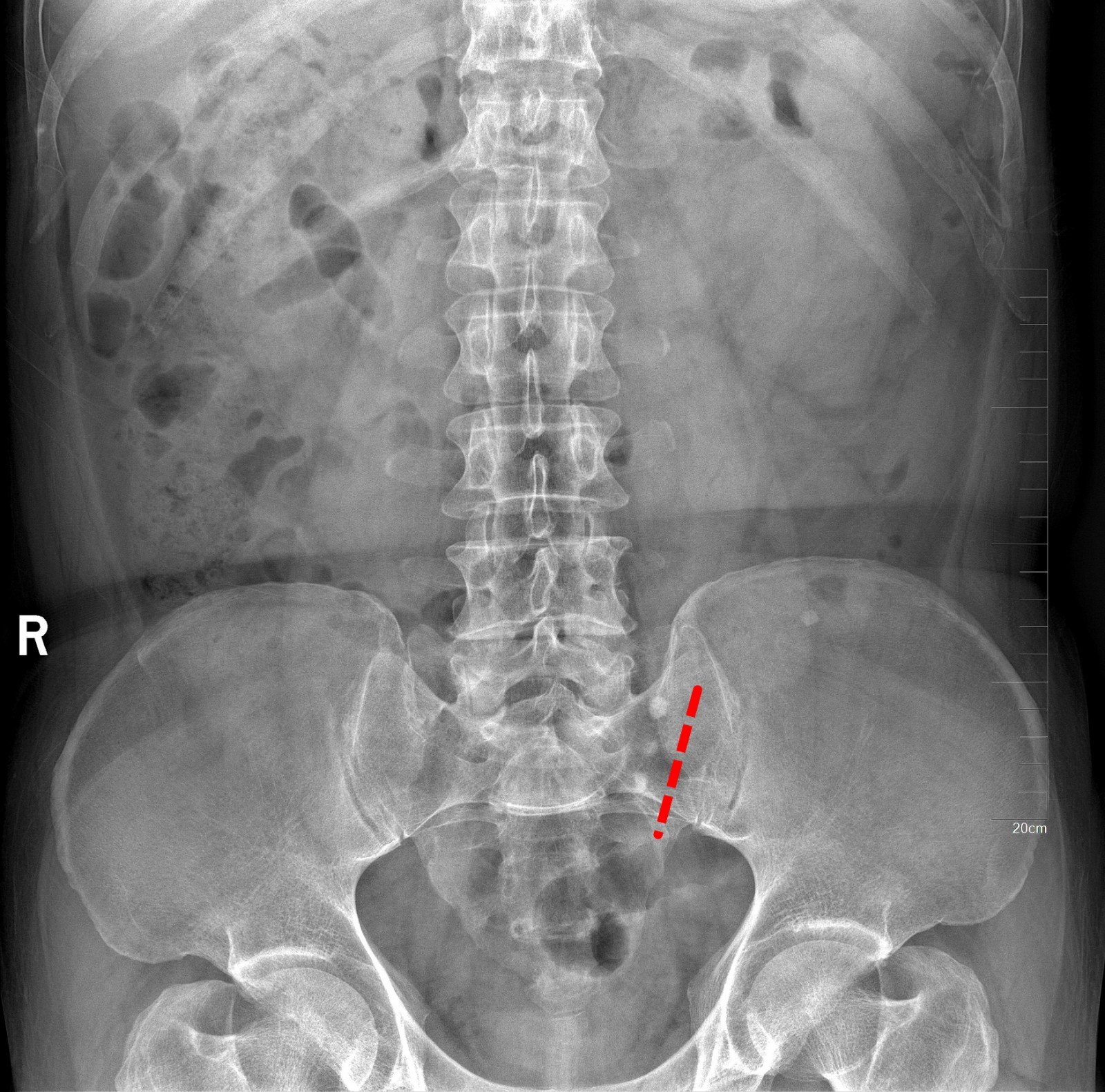 1591099292265840.jpg 1_副本.jpg