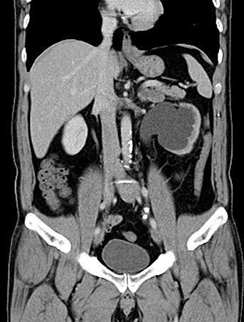 1591099381381182.jpg 31_副本.jpg