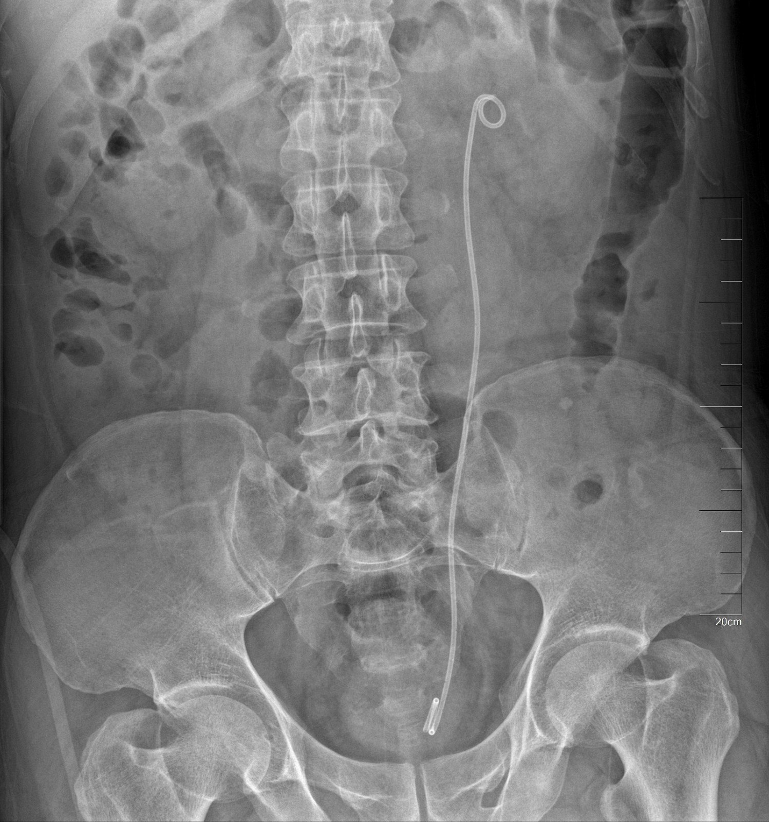 1591534281481529.jpg 1.JPG