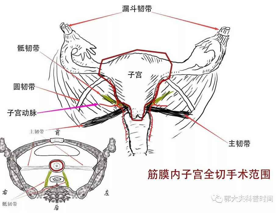 1507363938142521.png blob.png