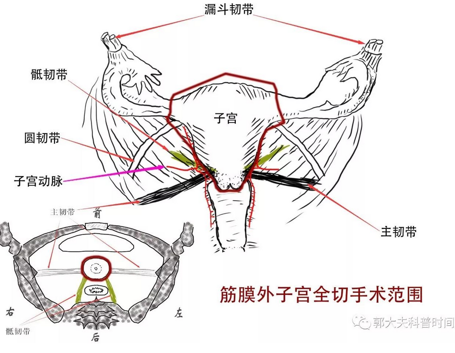 1507363954965660.png blob.png