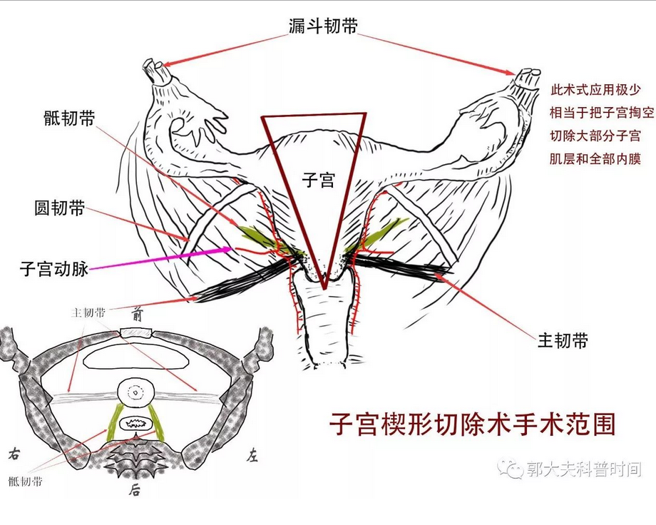 1507363997142831.png blob.png