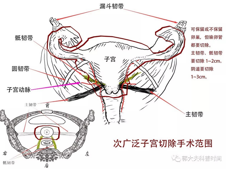 1507364012135023.png blob.png