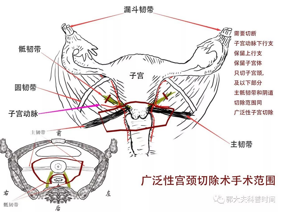 1507364047261890.png blob.png