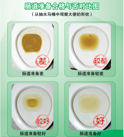 肠道准备合格与否.png