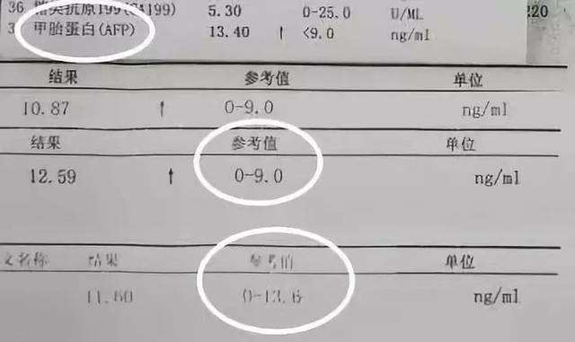 甲胎蛋白正常值参考范围。.jpg